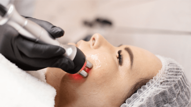 RF facial skin tightening Brisbane