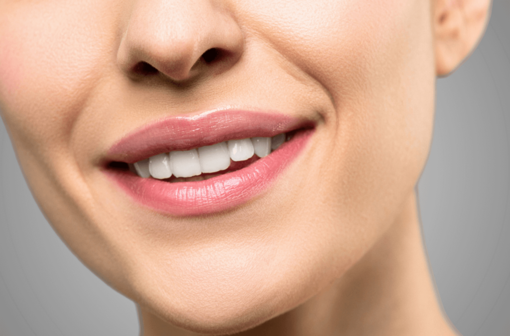 teeth whitening Brisbane