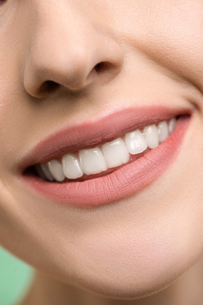 teeth whitening Brisbane