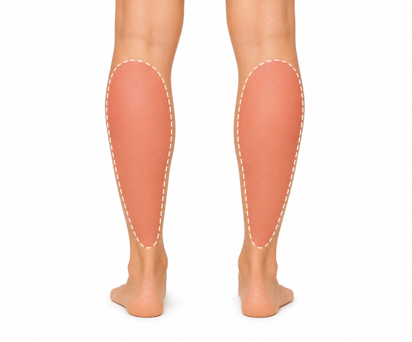 Calves