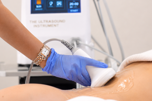 Ultrasound Fat Cavitation