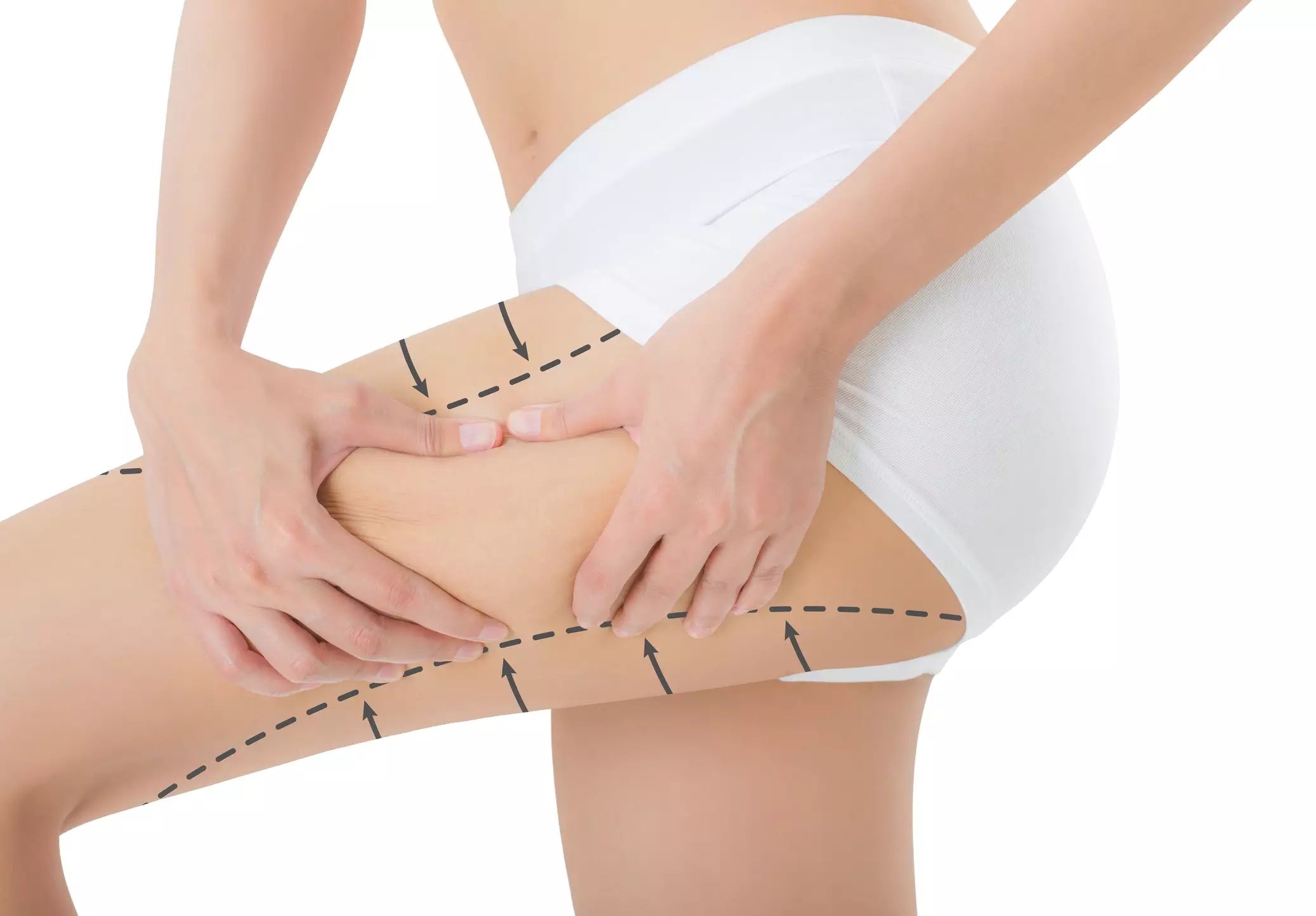 Thigh treatment at our Brisbane clinic