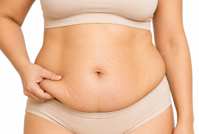 Fat Cavitation for Post-pregnancy softness in Brisbane