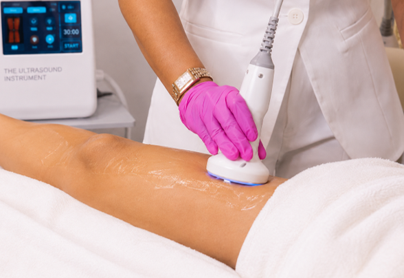 RF Skin Tightening