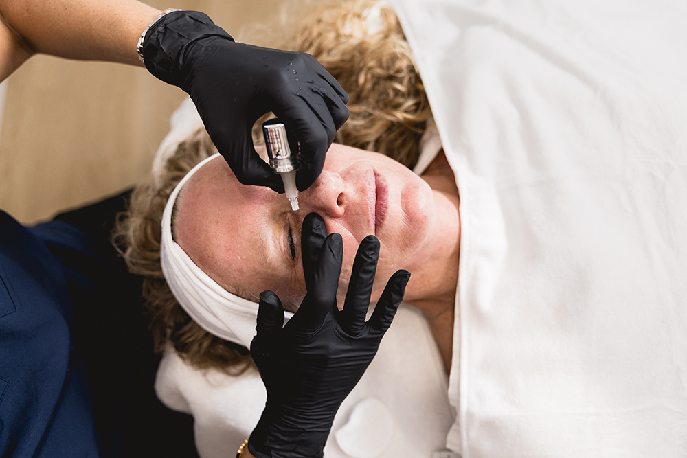 SQT Bio-Microneedling