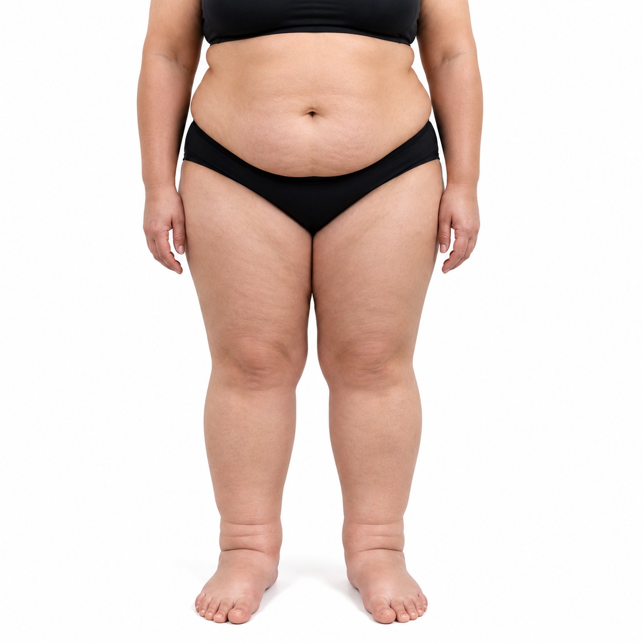 Solutions for Water Retention & Puffiness in Brisbane