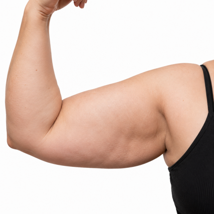 Water retention or general bloating