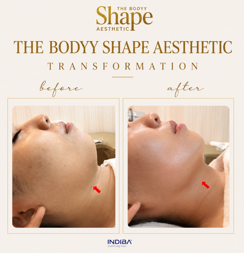 INDIBA Skin Tightening Treatment treatment result