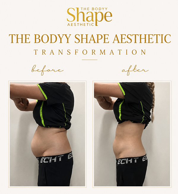 transformation 5_tbsa