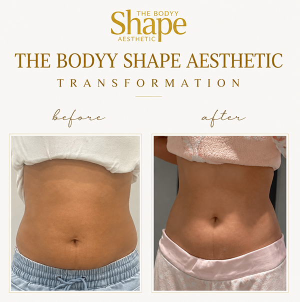 transformation _tbsa 3