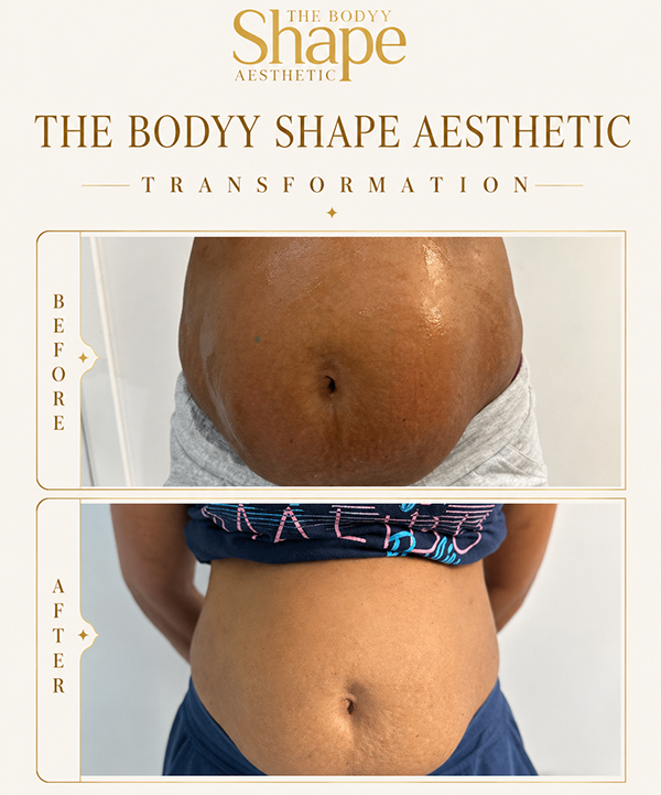 transfromation 6 _ tbsa